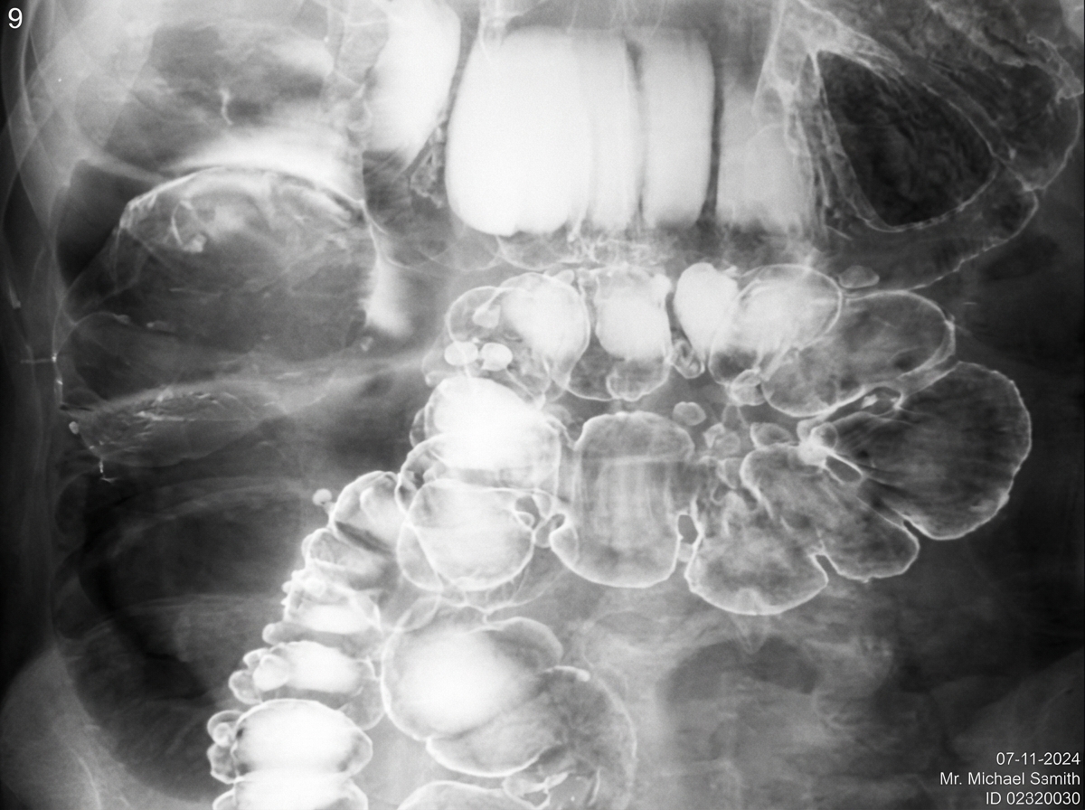 Image for question 475