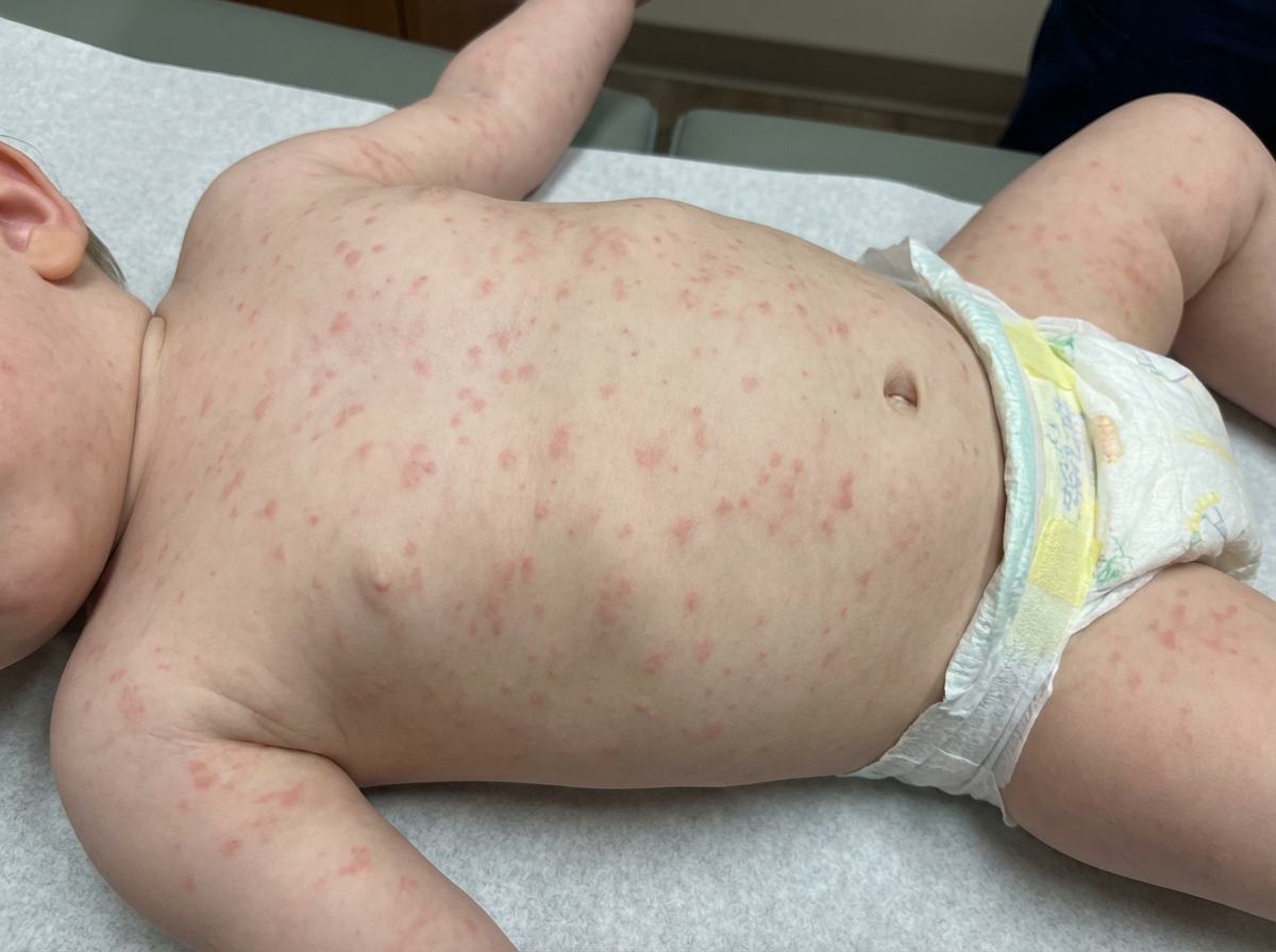 Image for question 168