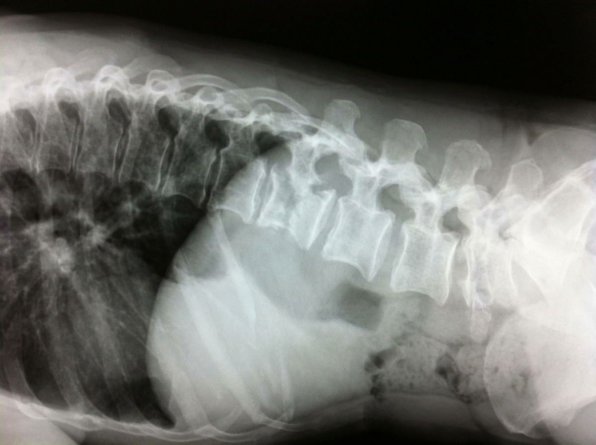 Image for question 239