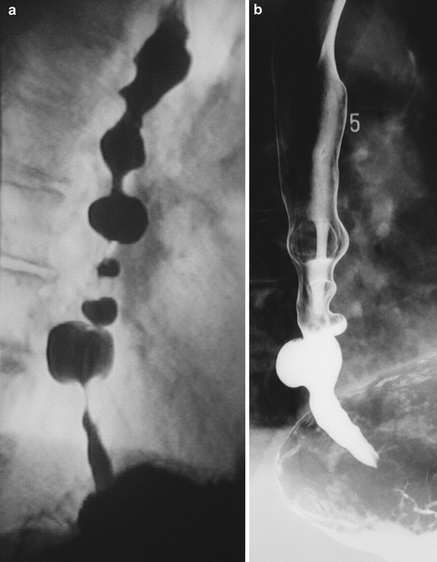 Image for question 45