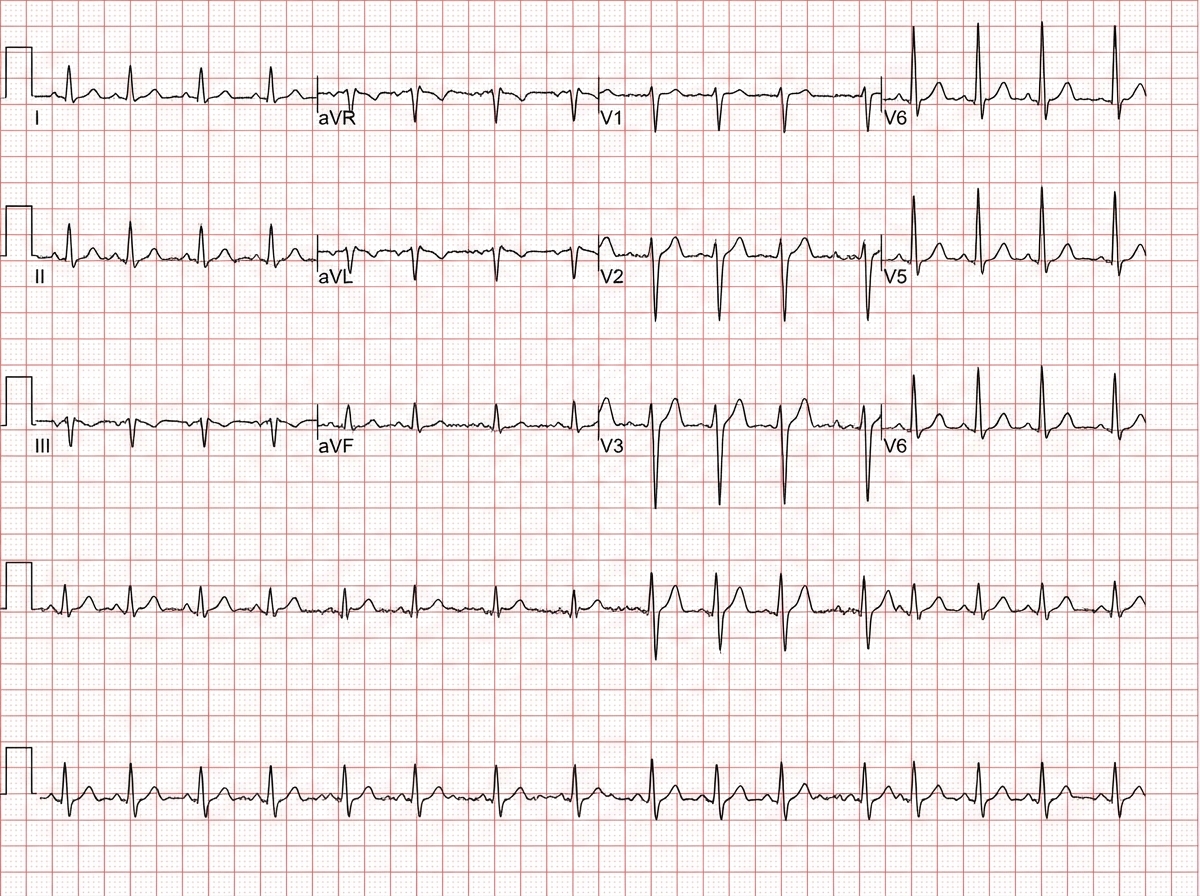 Image for question 7