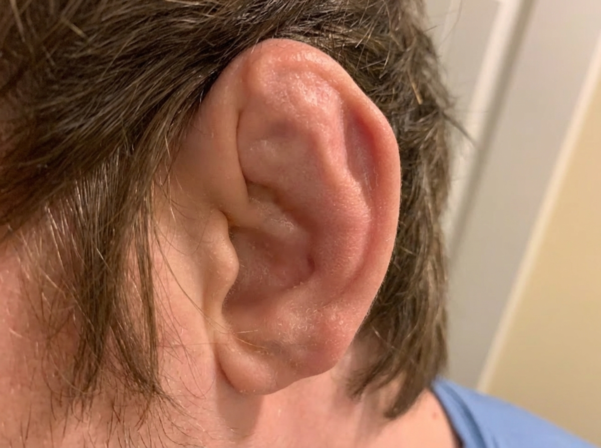 Image for question 55