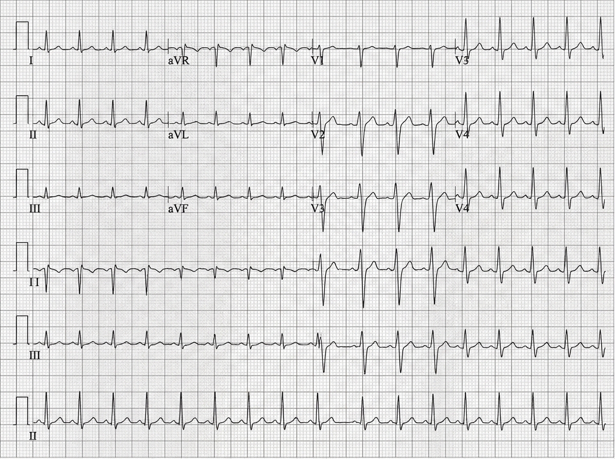 Image for question 1