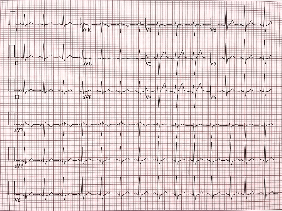Image for question 1041
