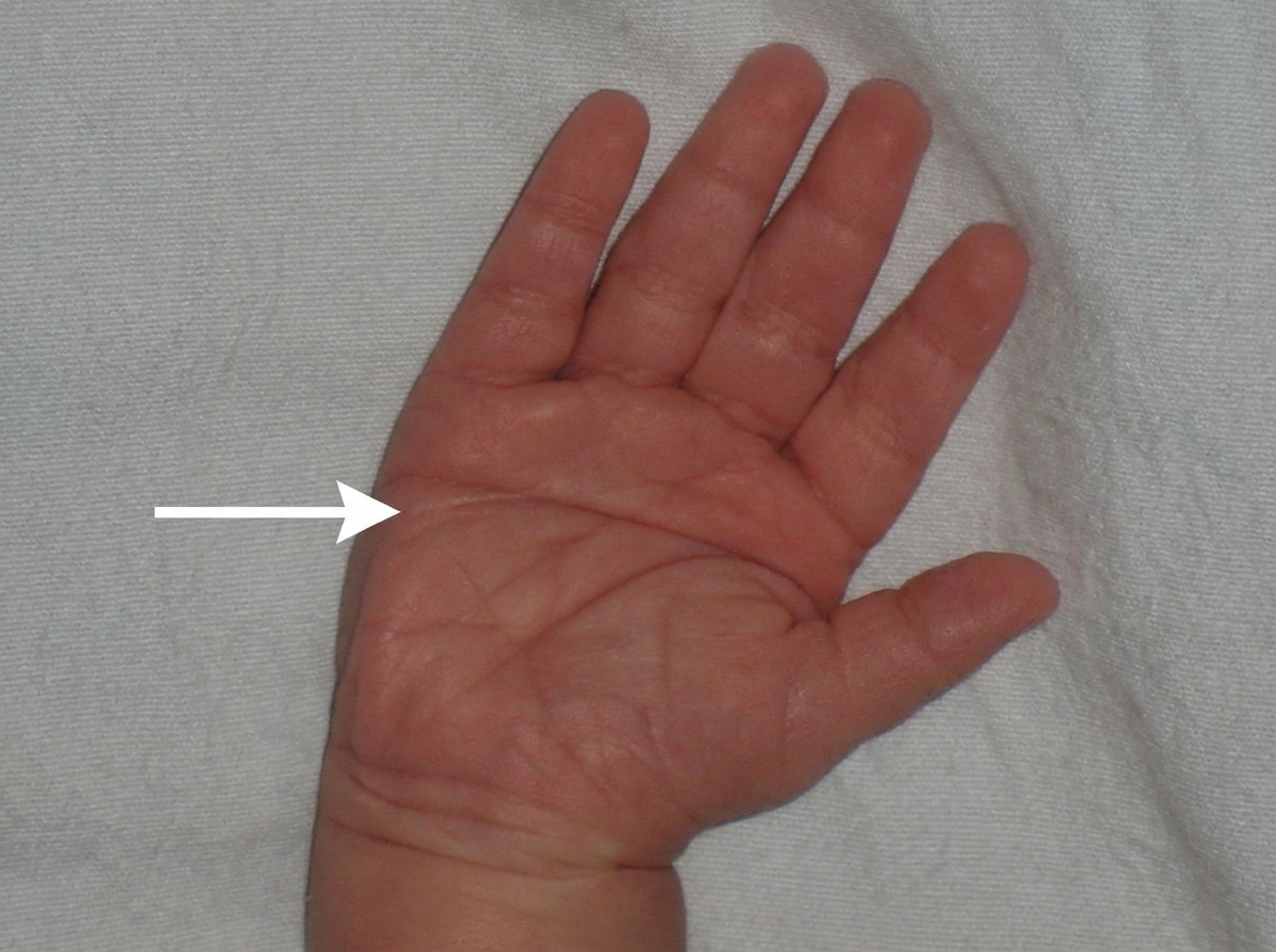 Image for question 631