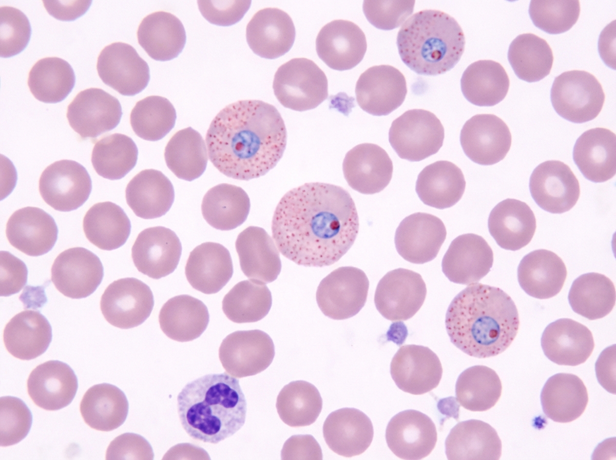 Image for question 715