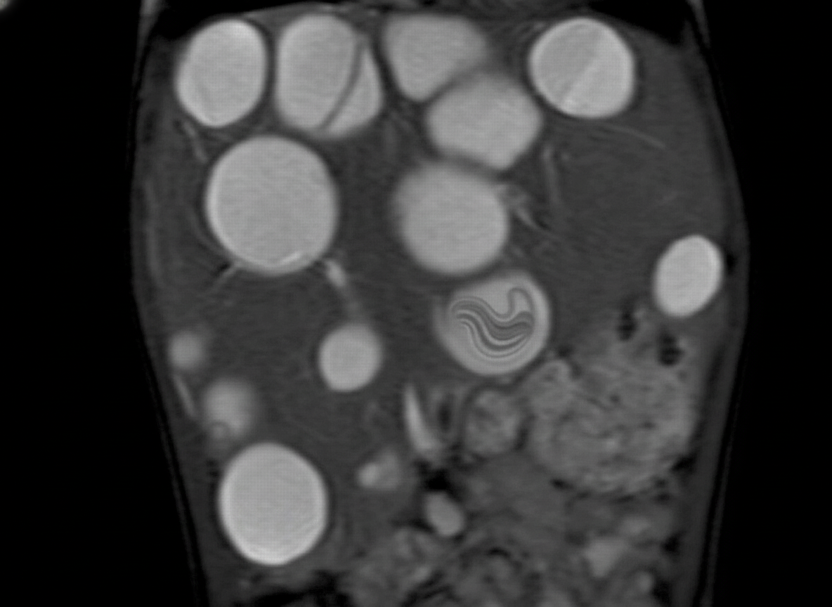 Image for question 445