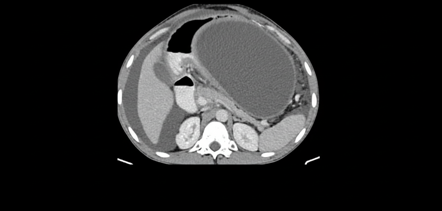 Image for question 222