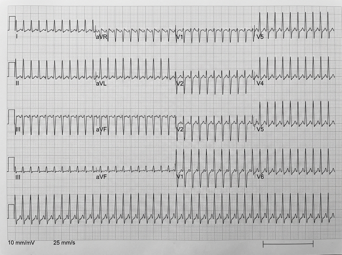 Image for question 891