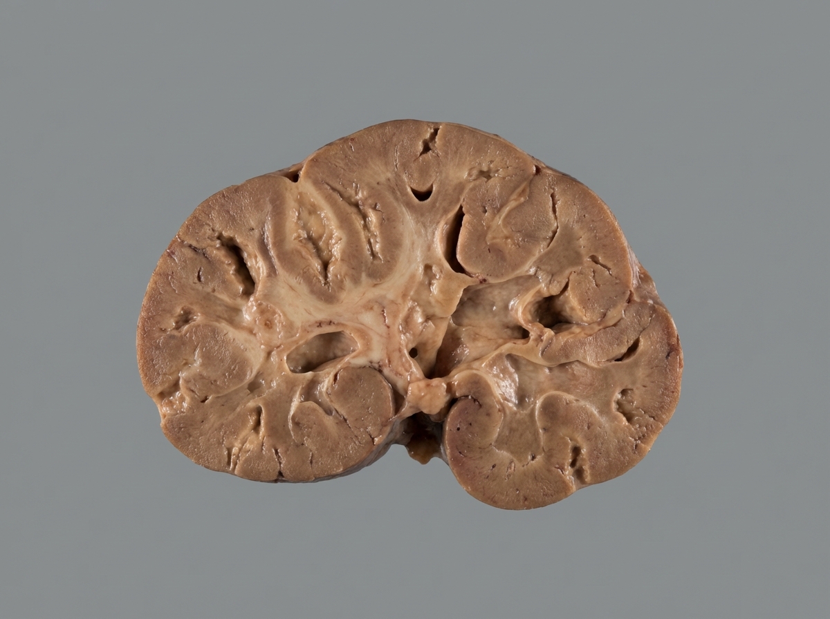 Image for question 439