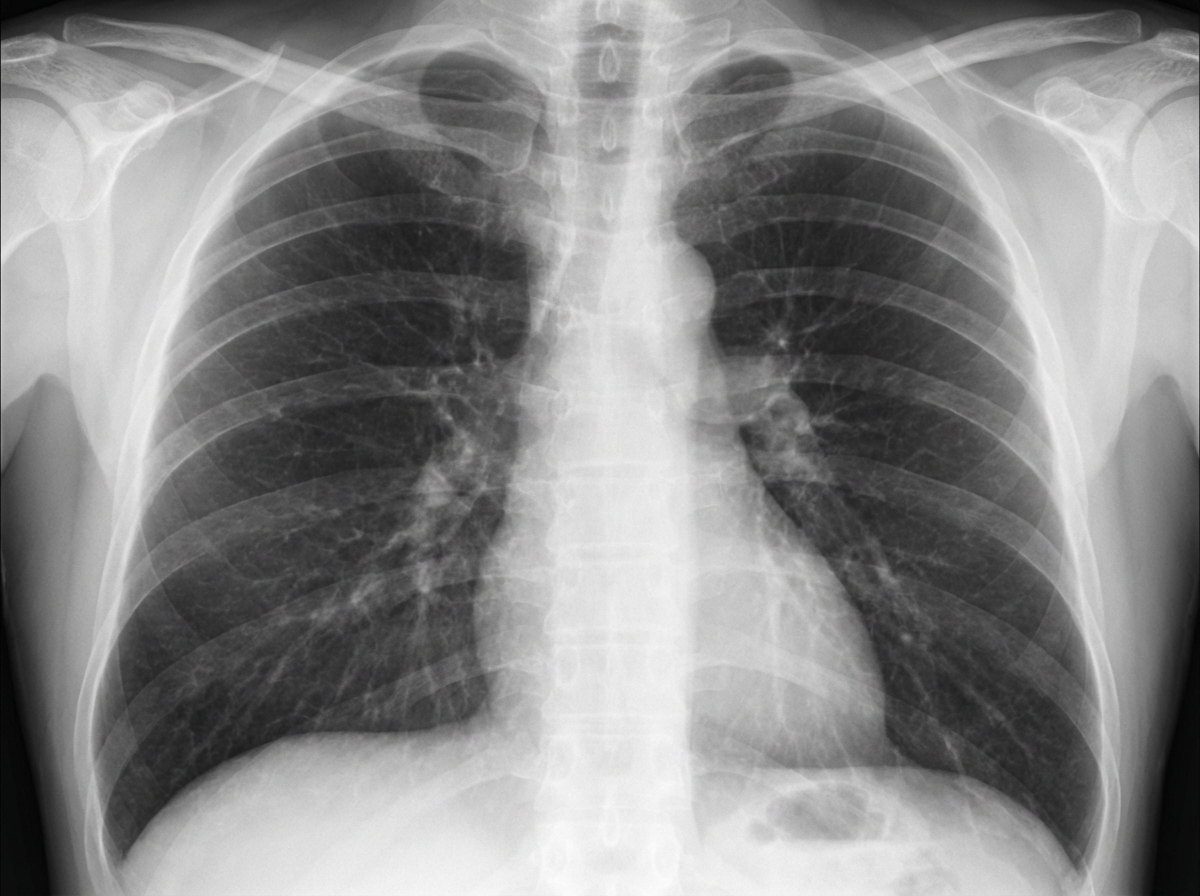 Image for question 499