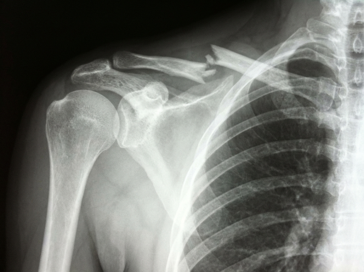 Image for question 128