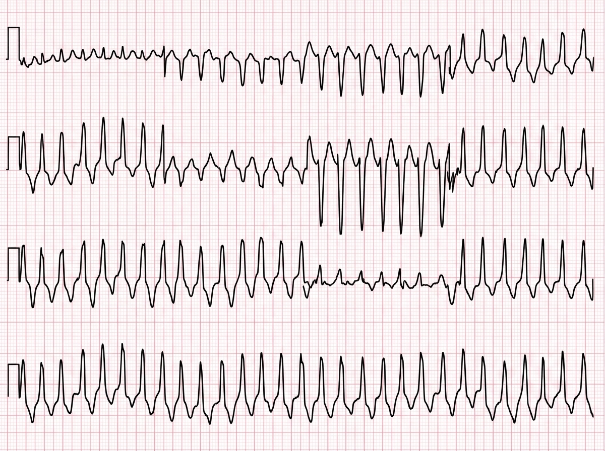 Image for question 194