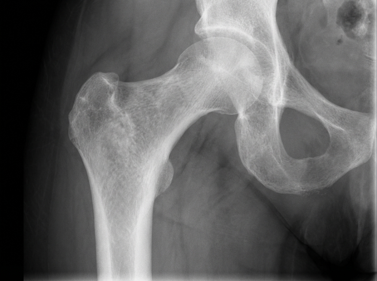 Image for question 110