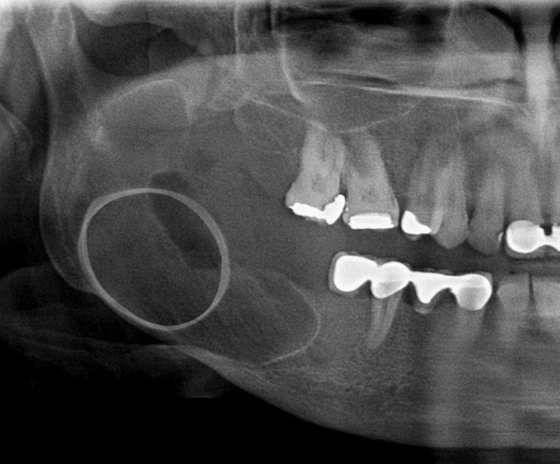 Image for question 115