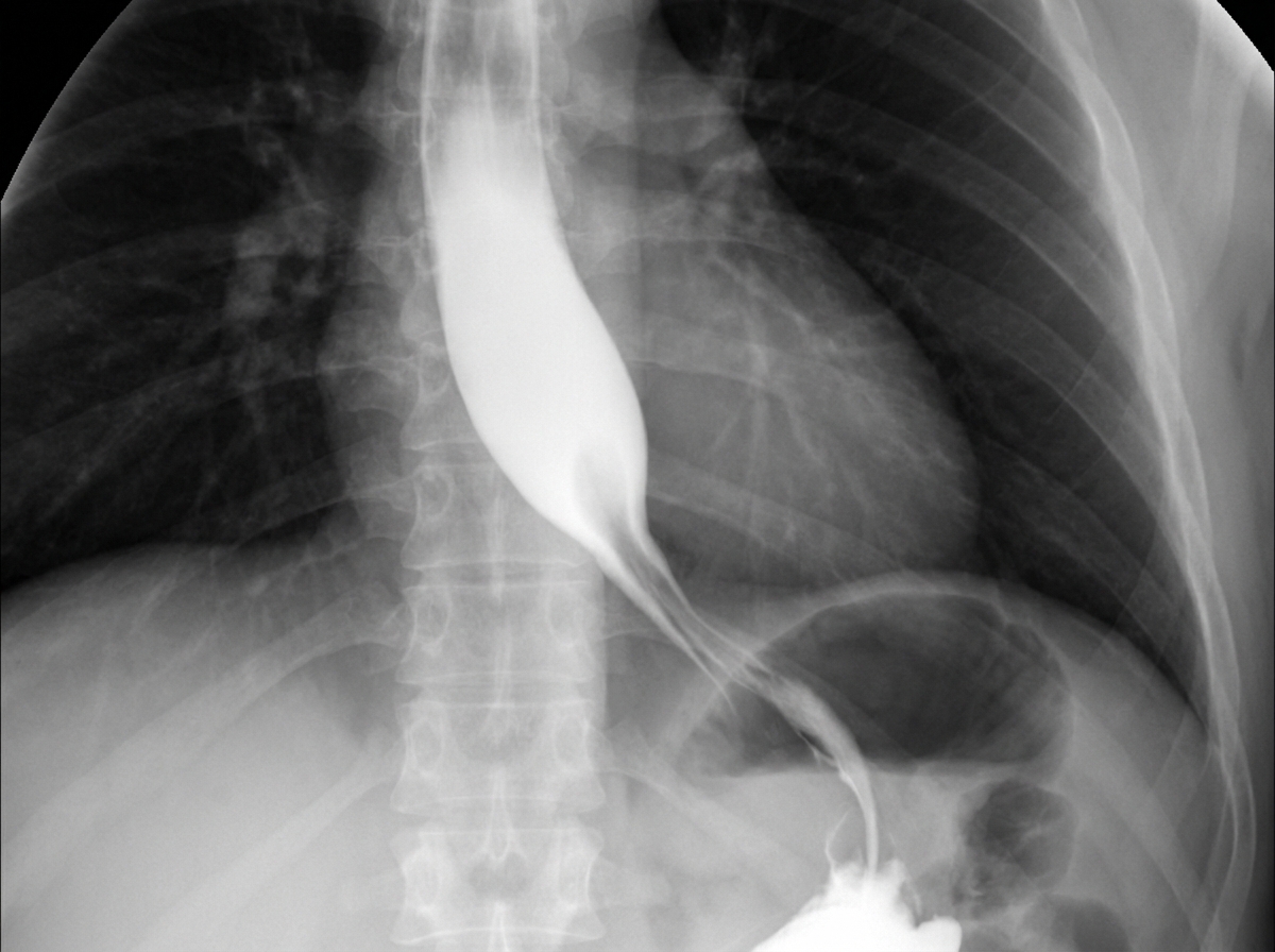 Image for question 58