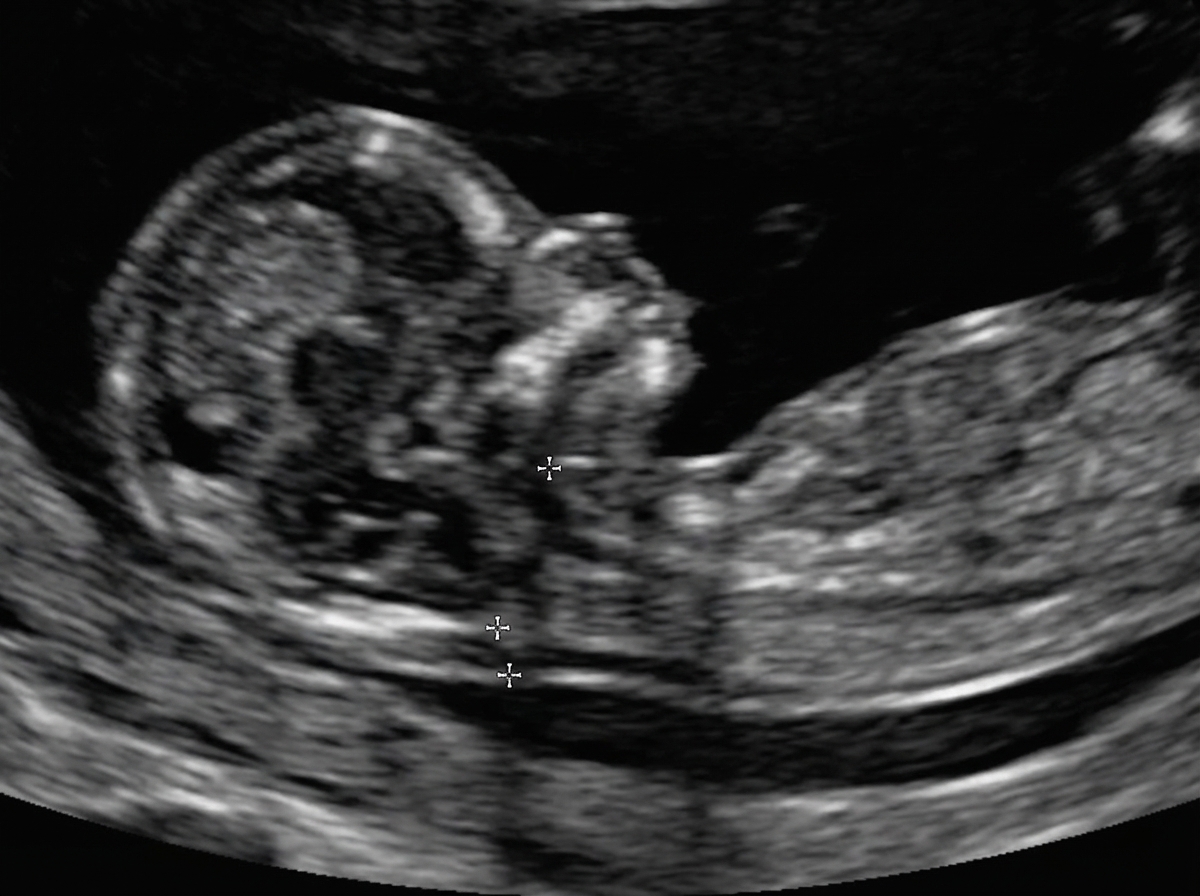 Image for question 316