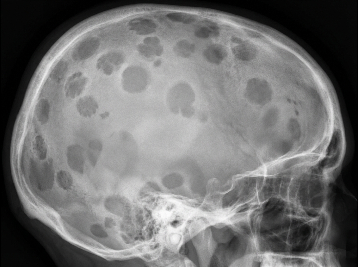 Image for question 149