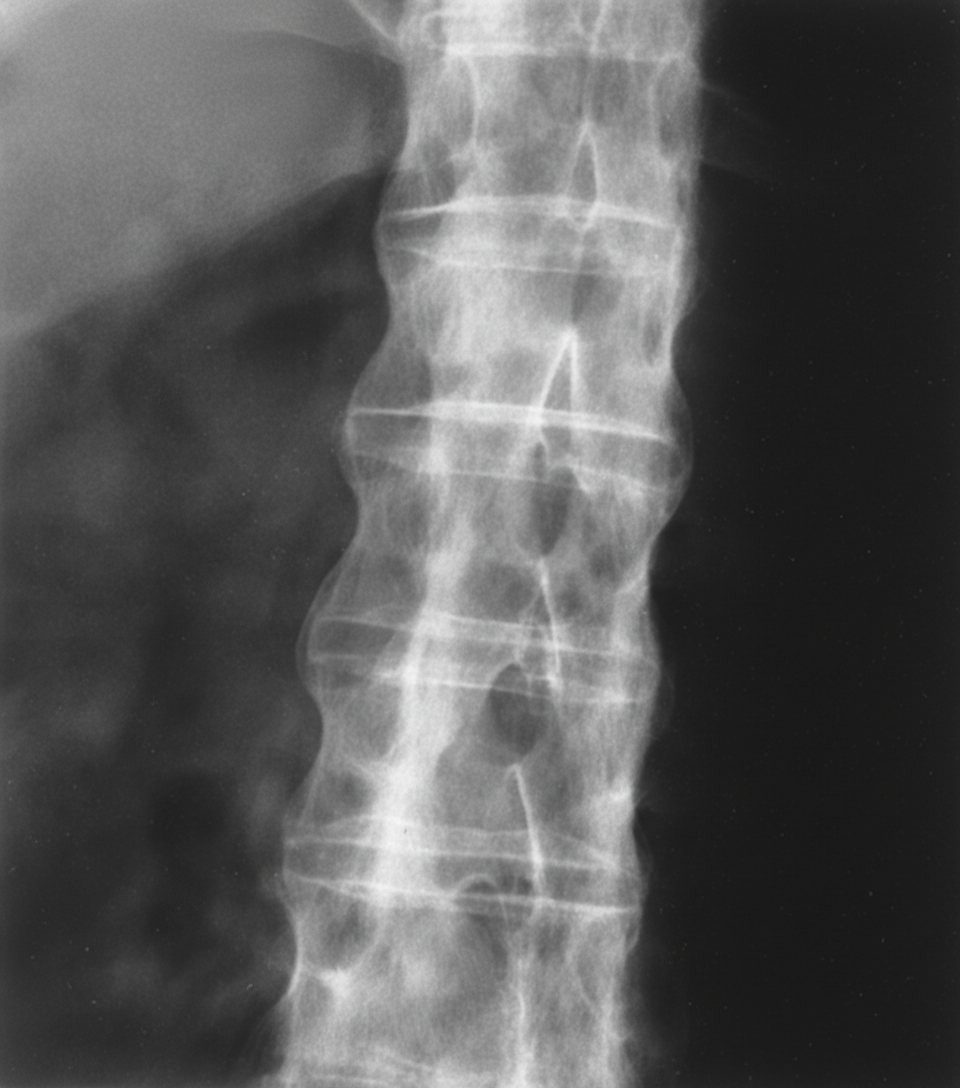 Image for question 136