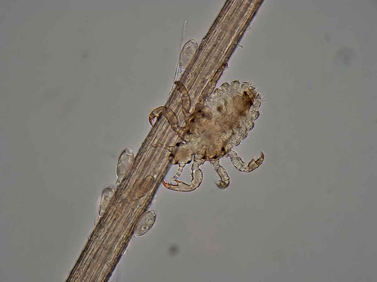 Image for question 30