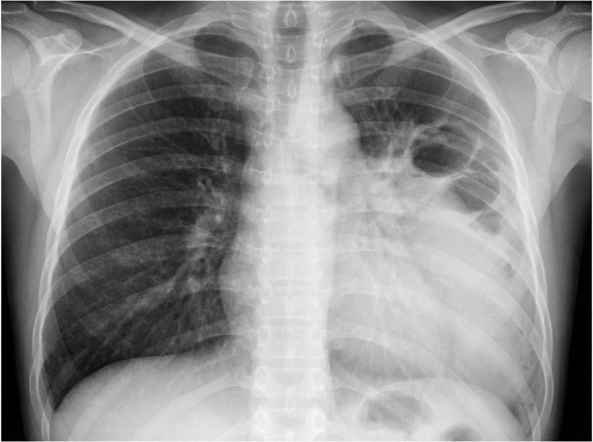 Image for question 49