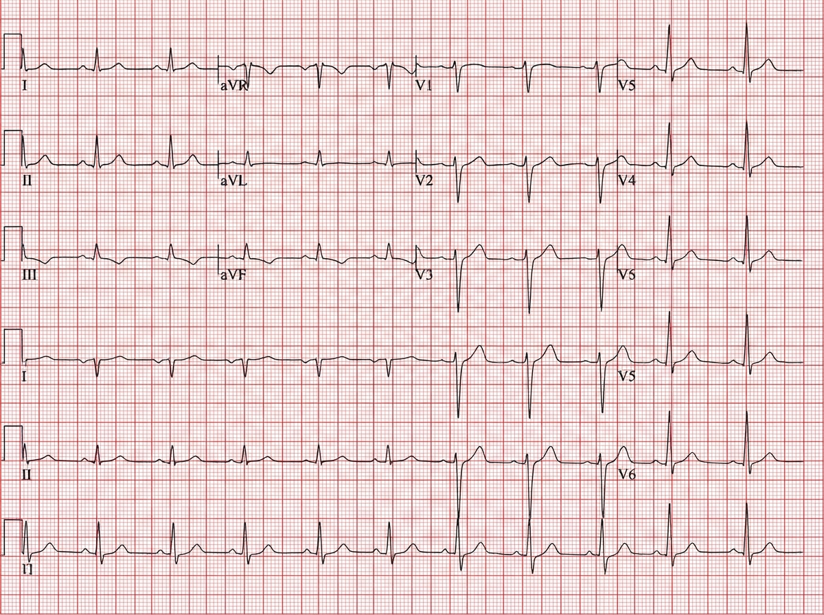Image for question 43