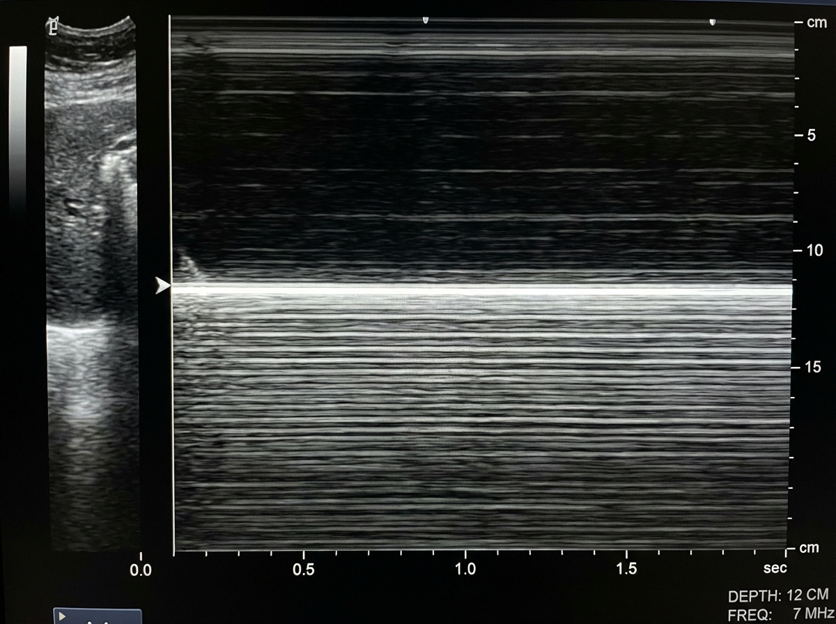 Image for question 141