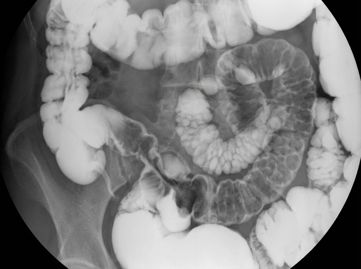 Image for question 124