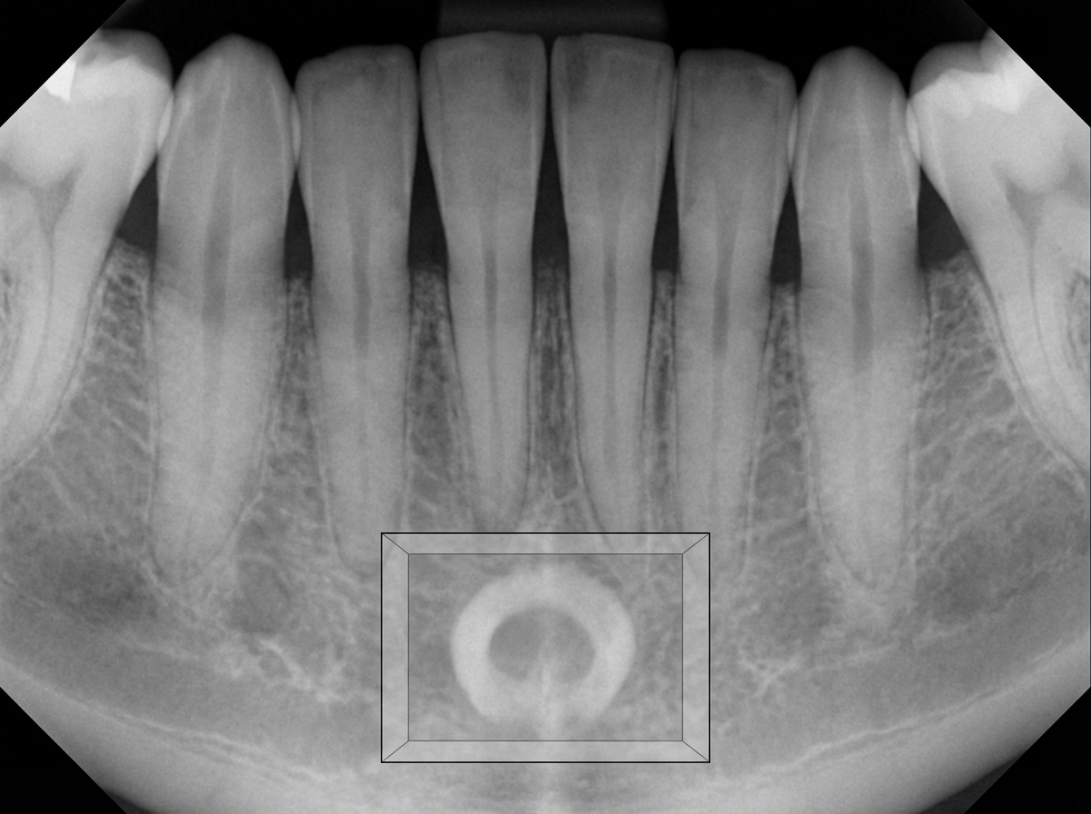 Image for question 110
