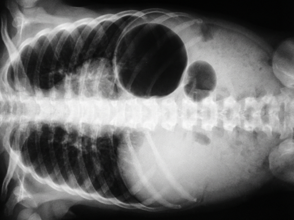 Image for question 242