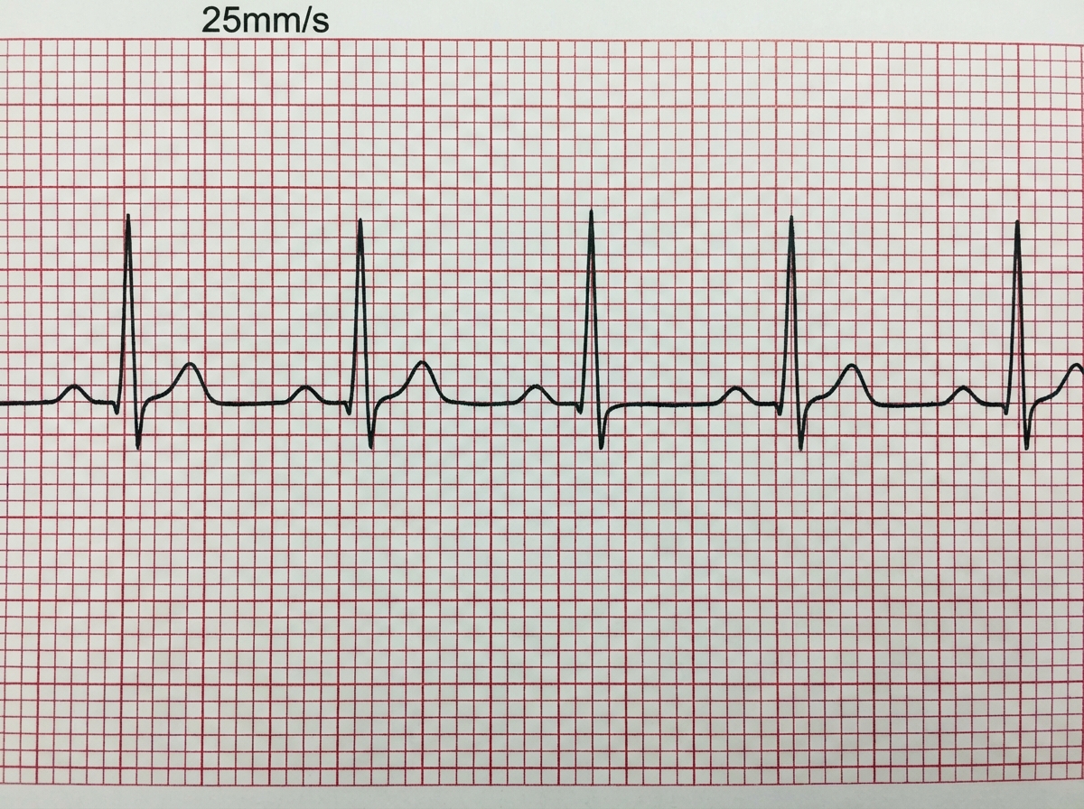 Image for question 38