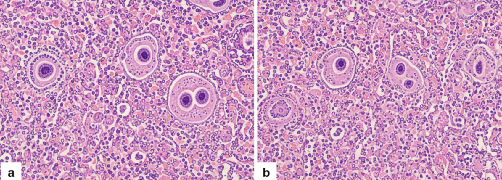 Image for question 288