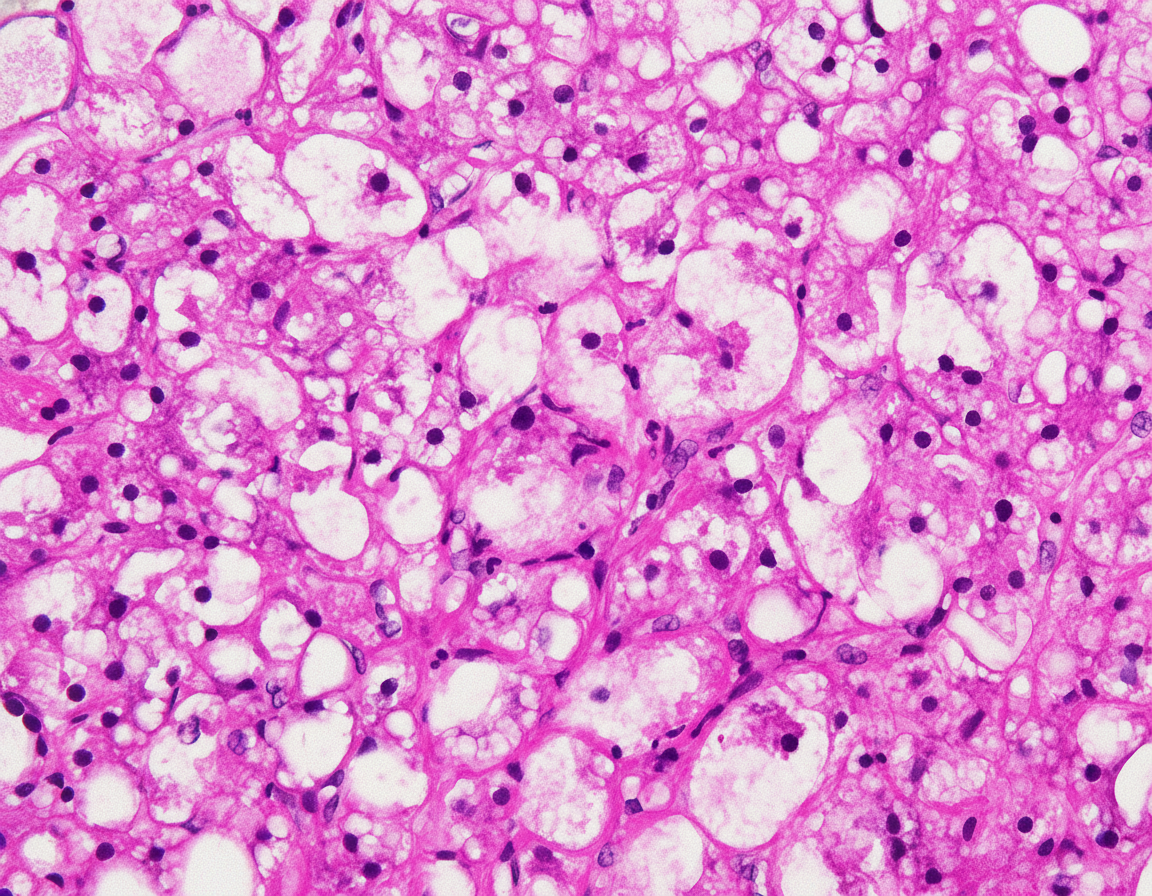 Image for question 85