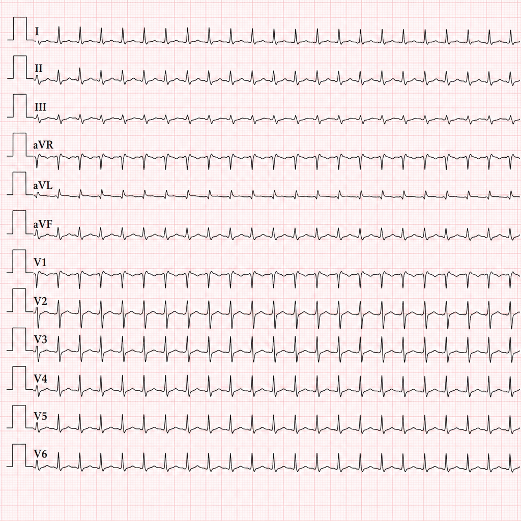 Image for question 1312