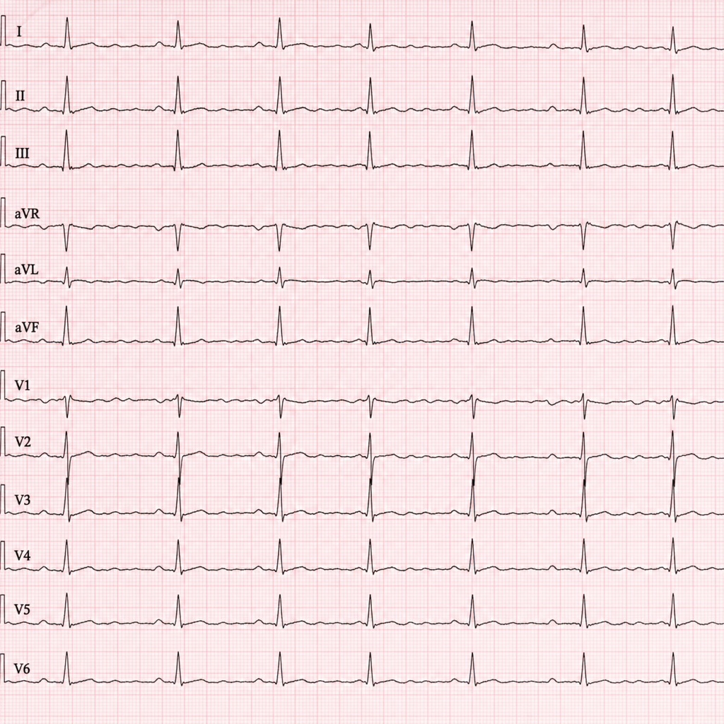Image for question 1197
