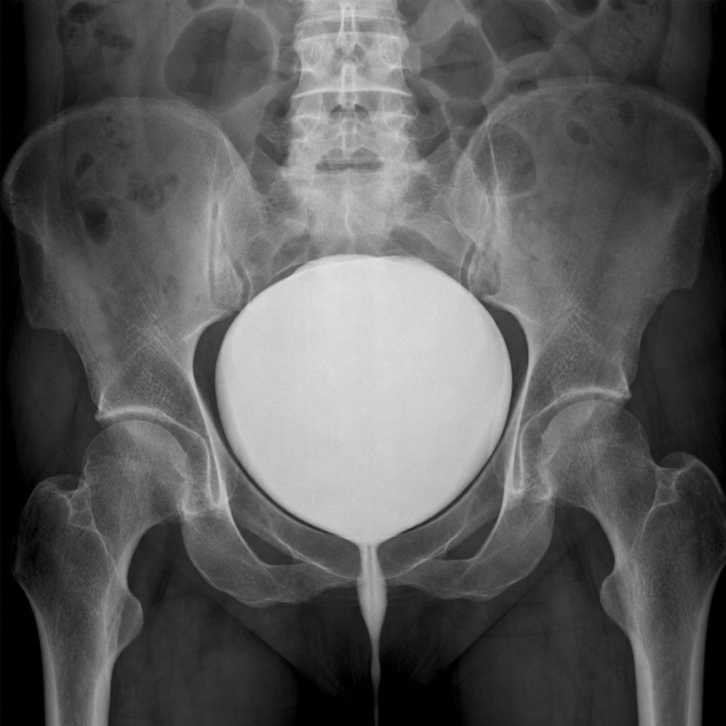 Image for question 104