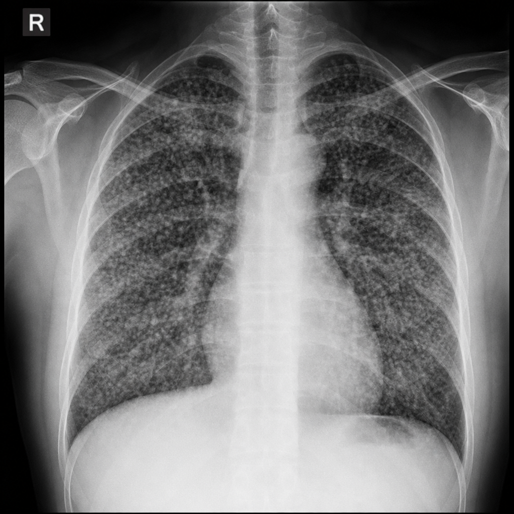 Image for question 298