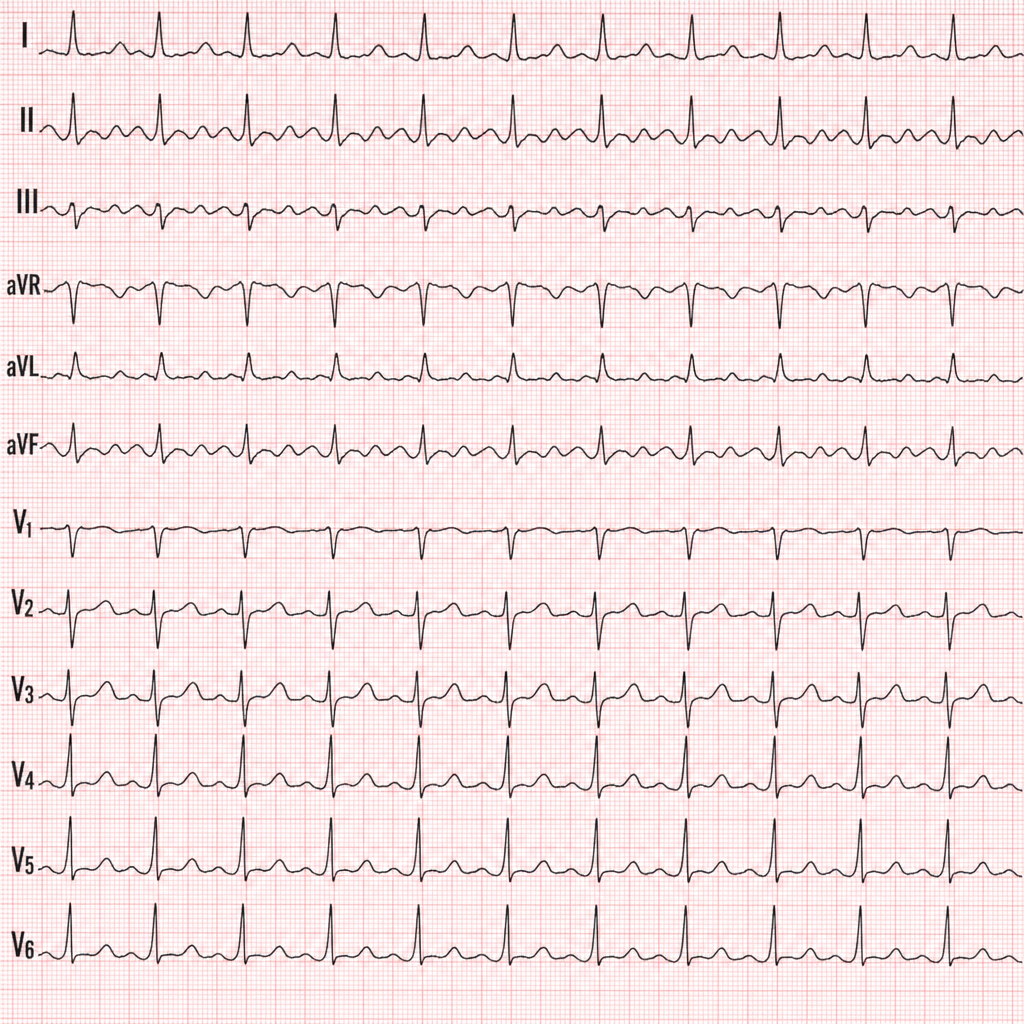 Image for question 14