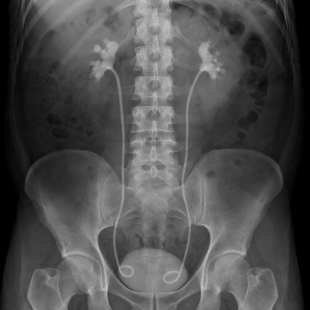 Image for question 502