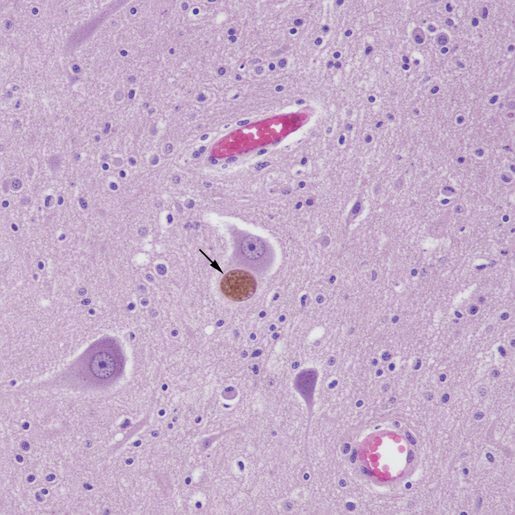 Image for question 9