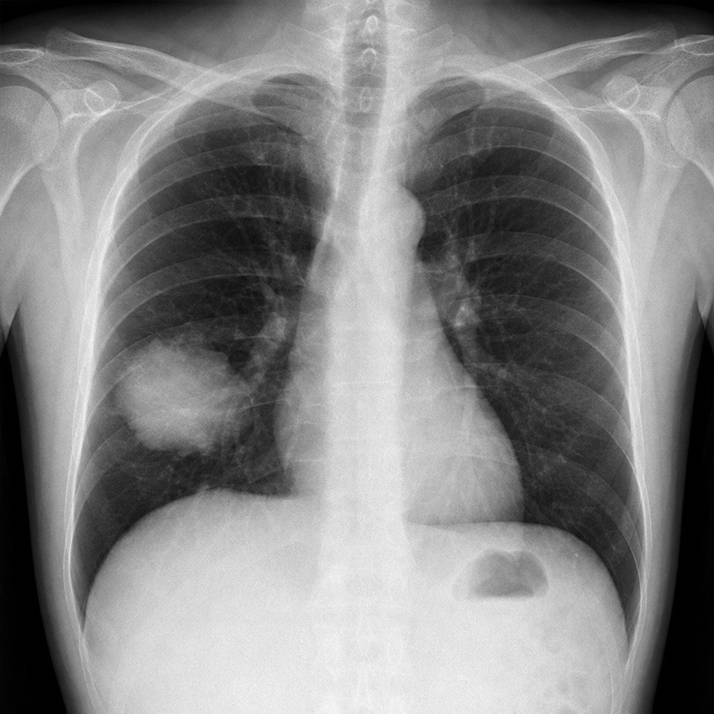 Image for question 59