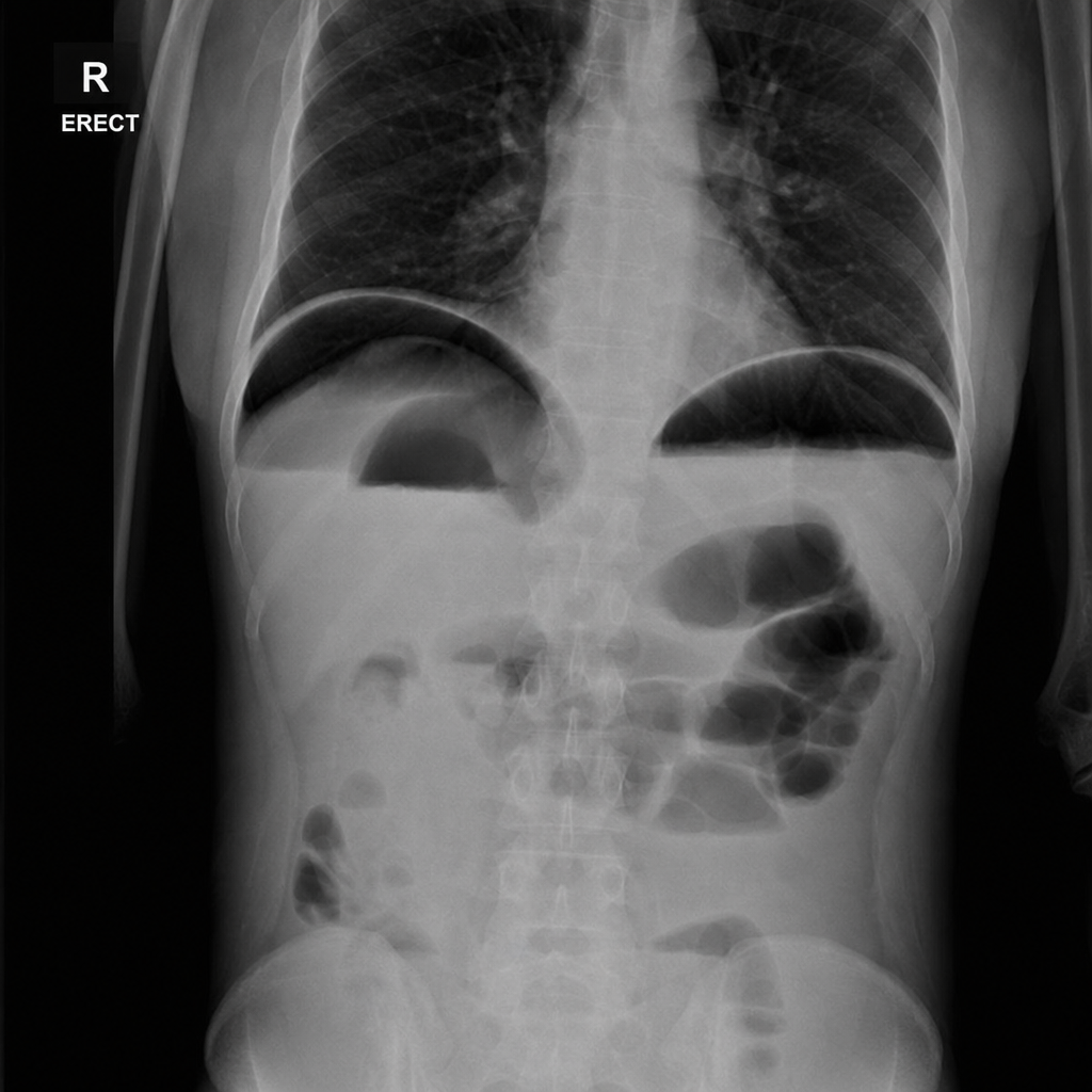 Image for question 214