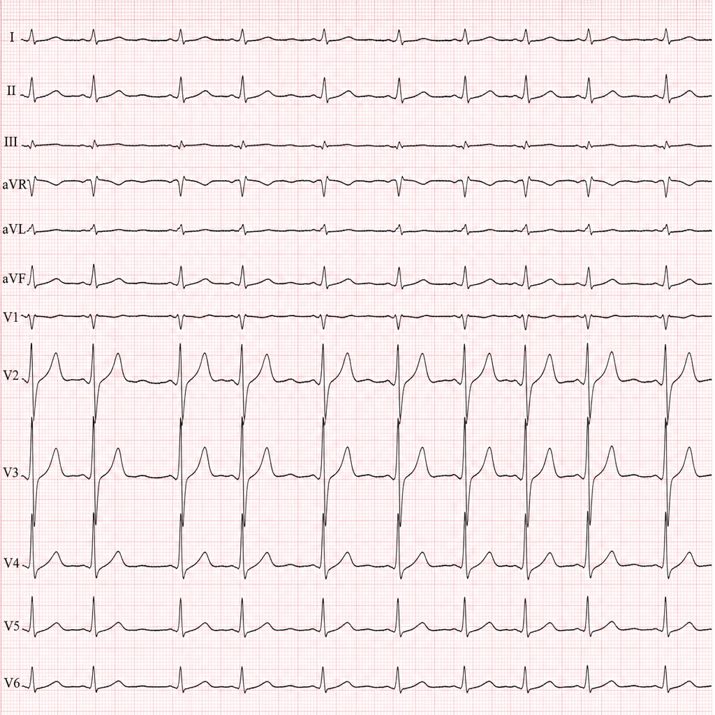 Image for question 55