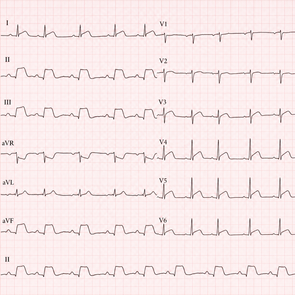Image for question 2