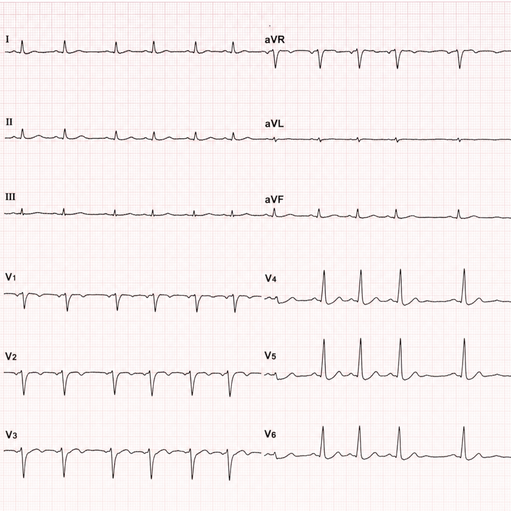 Image for question 2