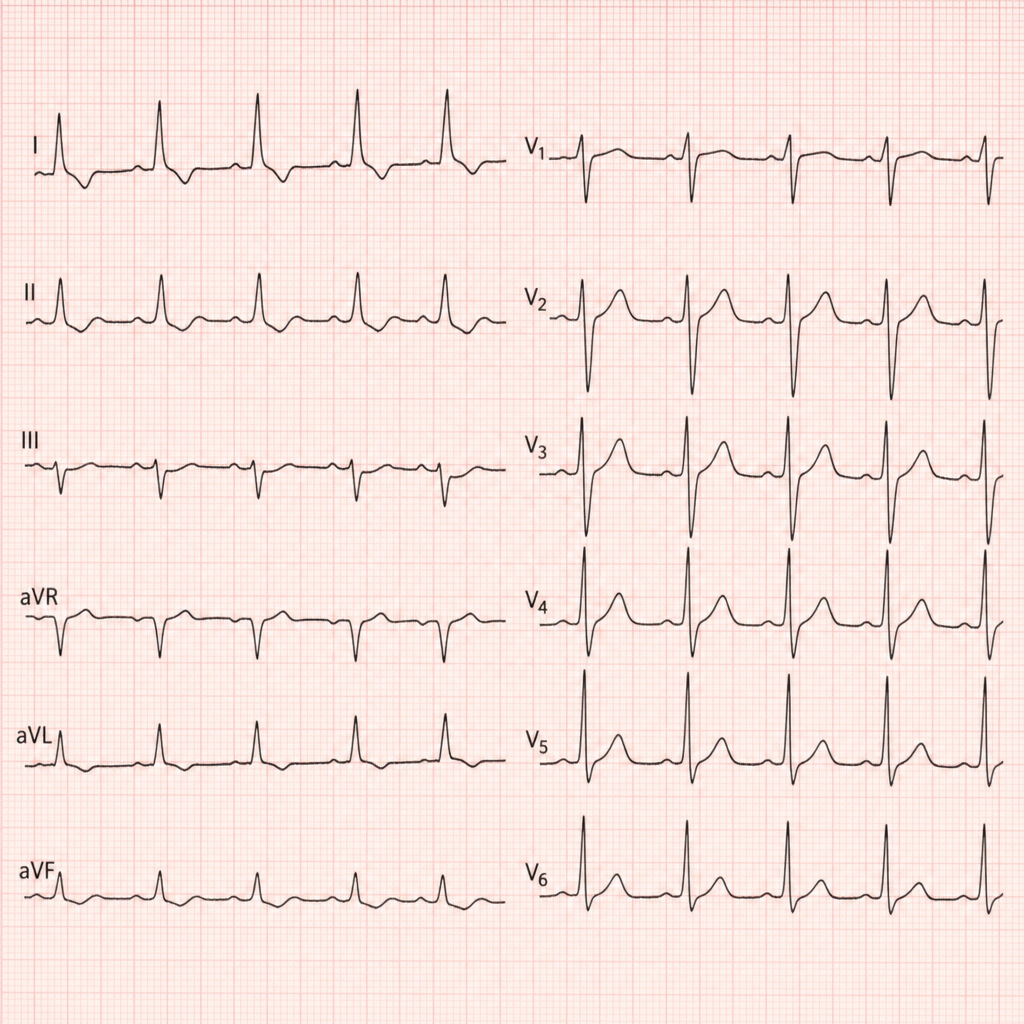 Image for question 2