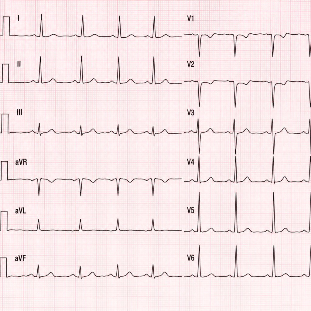 Image for question 50