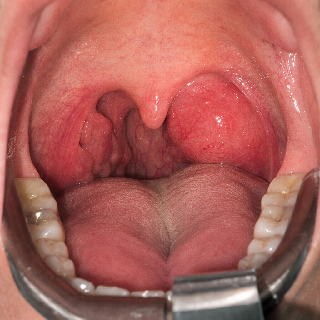 Image for question 262