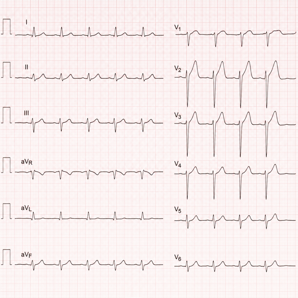 Image for question 47