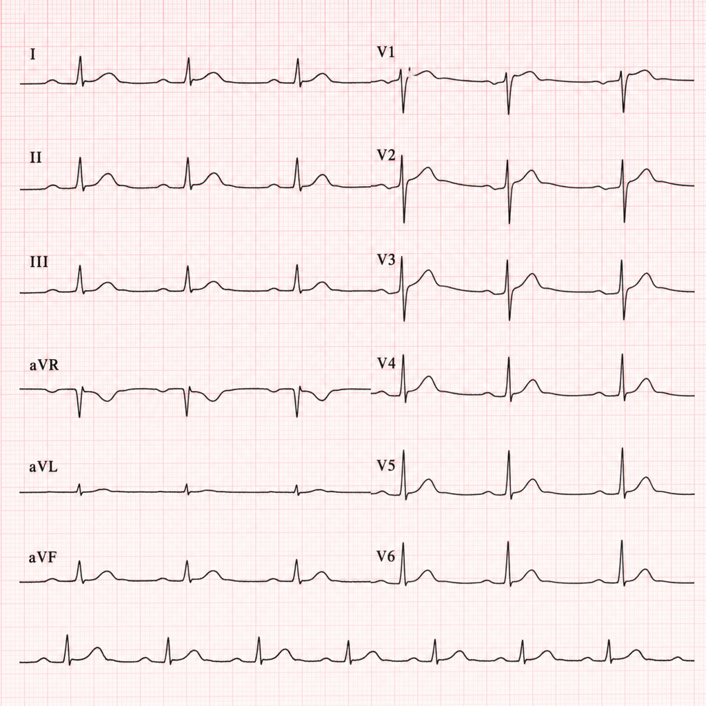 Image for question 4